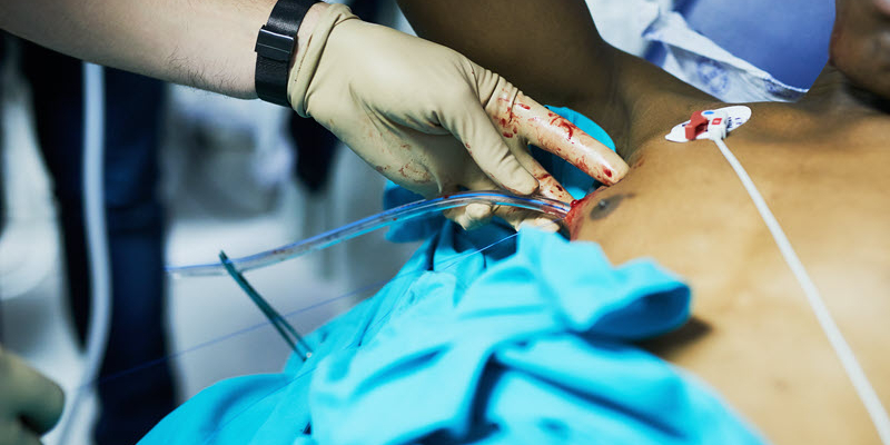 A medical professional inserts a tube into a patient’s chest, with visible blood and monitoring electrodes attached to the patient’s body.