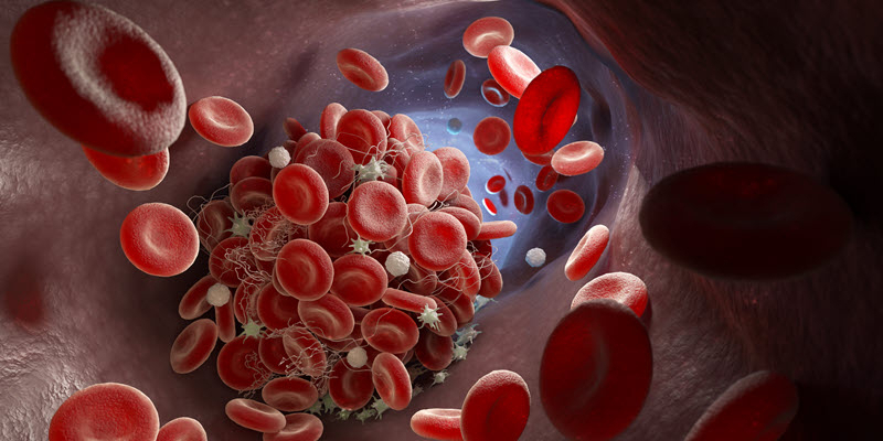A blood vessel with red blood cells and a blood clot forming, showing platelets clumping together inside the vessel.
