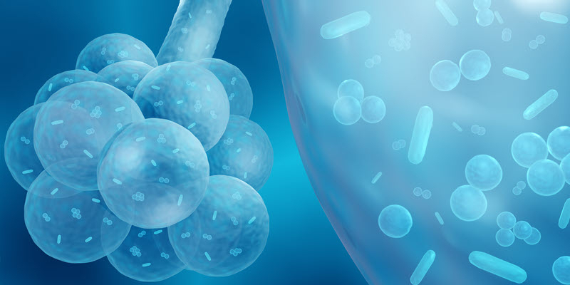 Digital illustration of lung alveoli with bacteria or microorganisms present, depicting an infection or respiratory condition at the microscopic level.