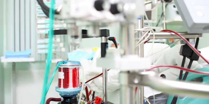 Close-up of medical equipment and tubes connected to a patient in a hospital setting, with a focus on a blood filtration or oxygenation device.