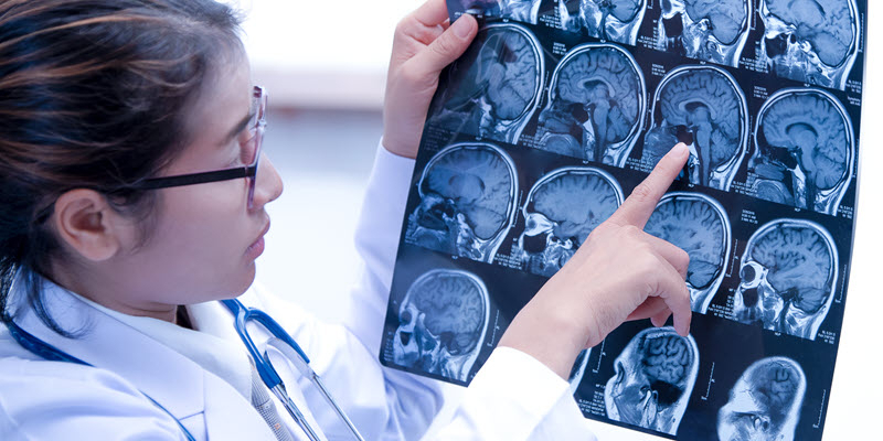 A doctor wearing glasses examines and points to a brain MRI scan, analyzing the images for diagnosis.