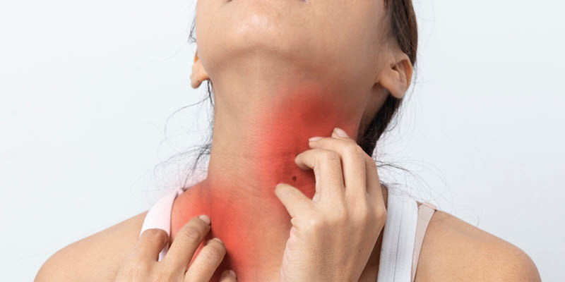 A person scratching their neck, which appears red and irritated, possibly indicating a skin rash or allergic reaction.
