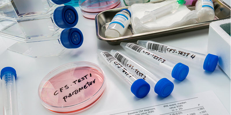 Laboratory workspace with labeled test tubes, a petri dish marked "CFS TEST 1 parameter," and various lab equipment and supplies.