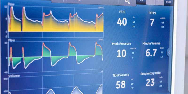 Close-up of a medical monitor displaying respiratory parameters, including FiO2, PEEP, peak pressure, minute volume, tidal volume, and respiratory rate with waveform graphs.