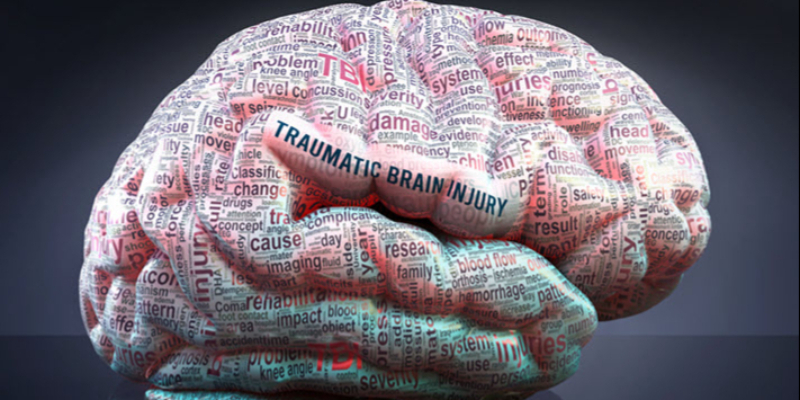 A model of a brain covered in words related to traumatic brain injury, with "TRAUMATIC BRAIN INJURY" prominently displayed across the center.