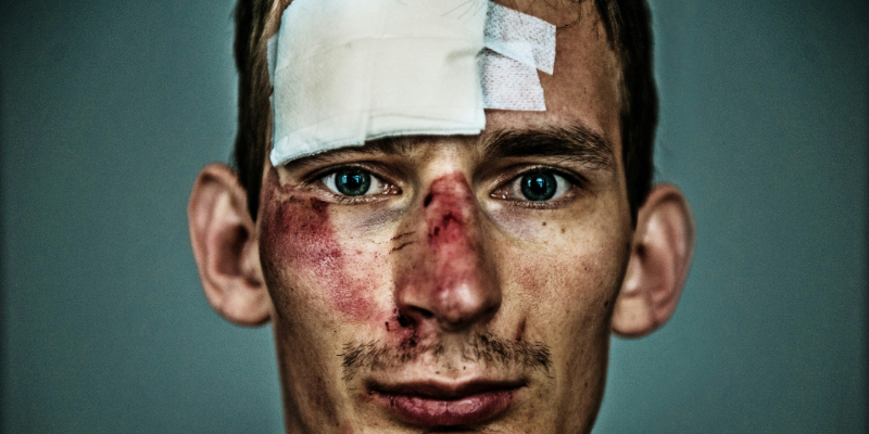 A man with visible facial injuries, including bruising, cuts, and a large bandage on his forehead, looks directly at the camera against a plain background.