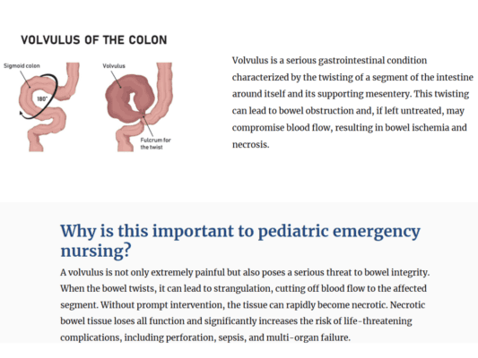 Diagram shows volvulus of the colon, with the sigmoid colon twisted 180 degrees. Text explains its risks, particularly for pediatric emergency nursing.
